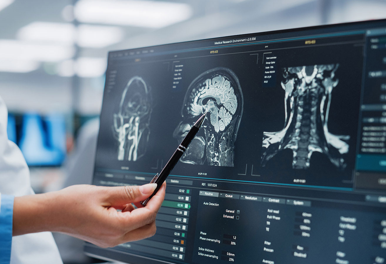 A close-up of a doctor reviewing brain scans. 