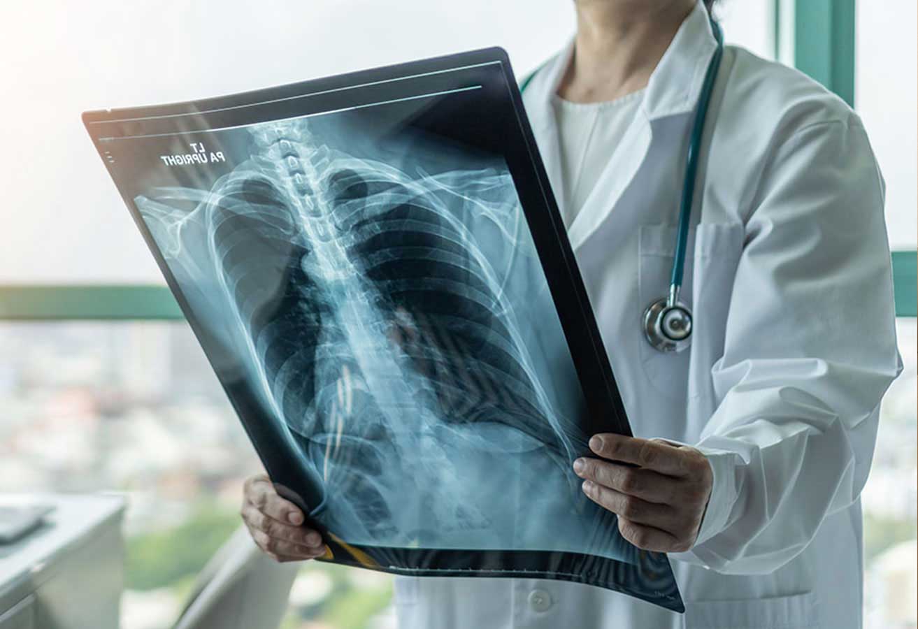 A doctor reviewing a lung scan. 